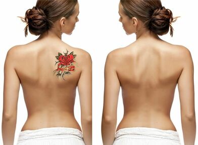 Laser Tattoo  Benign Pigmented Blemish RemovalLevel 4  Online Laser  Training Australia