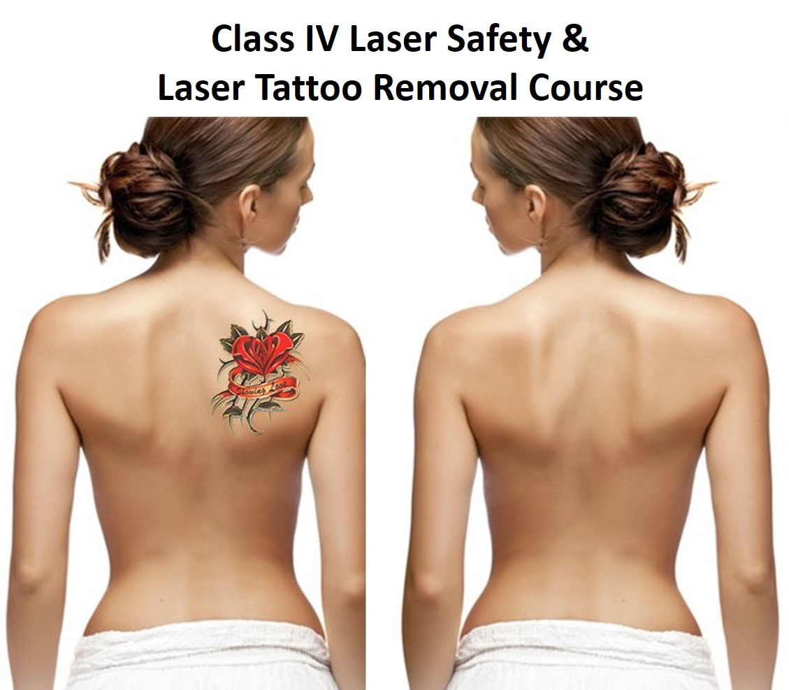 Geo Laser Tattoo Removal Treatment at Rs 1000inch  लजर टट रमवल  टरटमट लजर टट रमवल टरटमट टट क लजर तकनक स हटन क  सवए  laser tattoo removal 